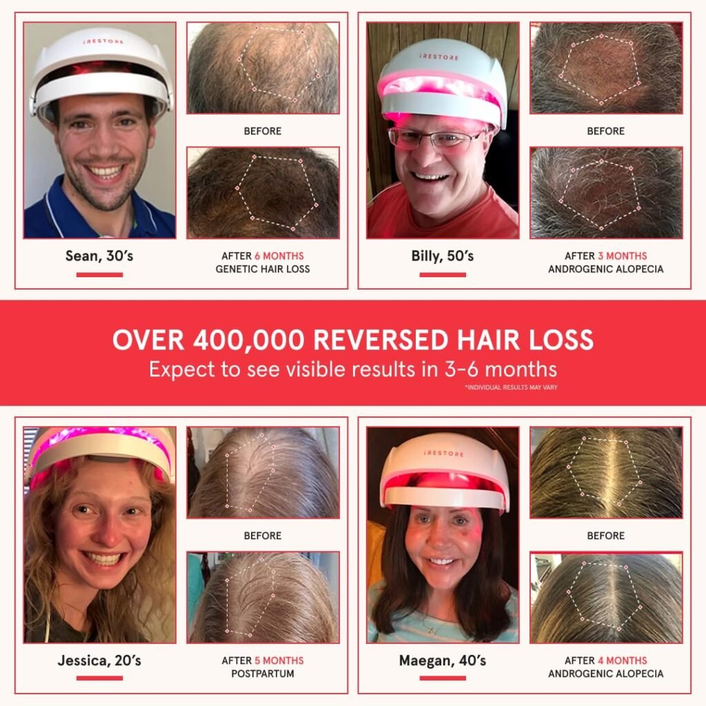 I-store Hair restore